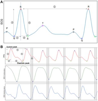 Continuous Vital Sign Analysis to Predict Secondary Neurological Decline After Traumatic Brain Injury